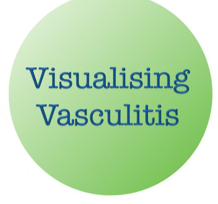 Logo for "Visualising Vasculitis" campaign from Vasculitis UK